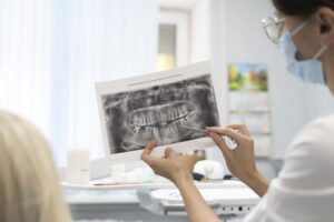 Imagen destacada de “Cómo interpretar las radiografías dentales: caries, periodoncia e implantes”