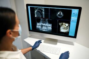 Imagen destacada de “Errores frecuentes en radiología dental y cómo evitarlos”