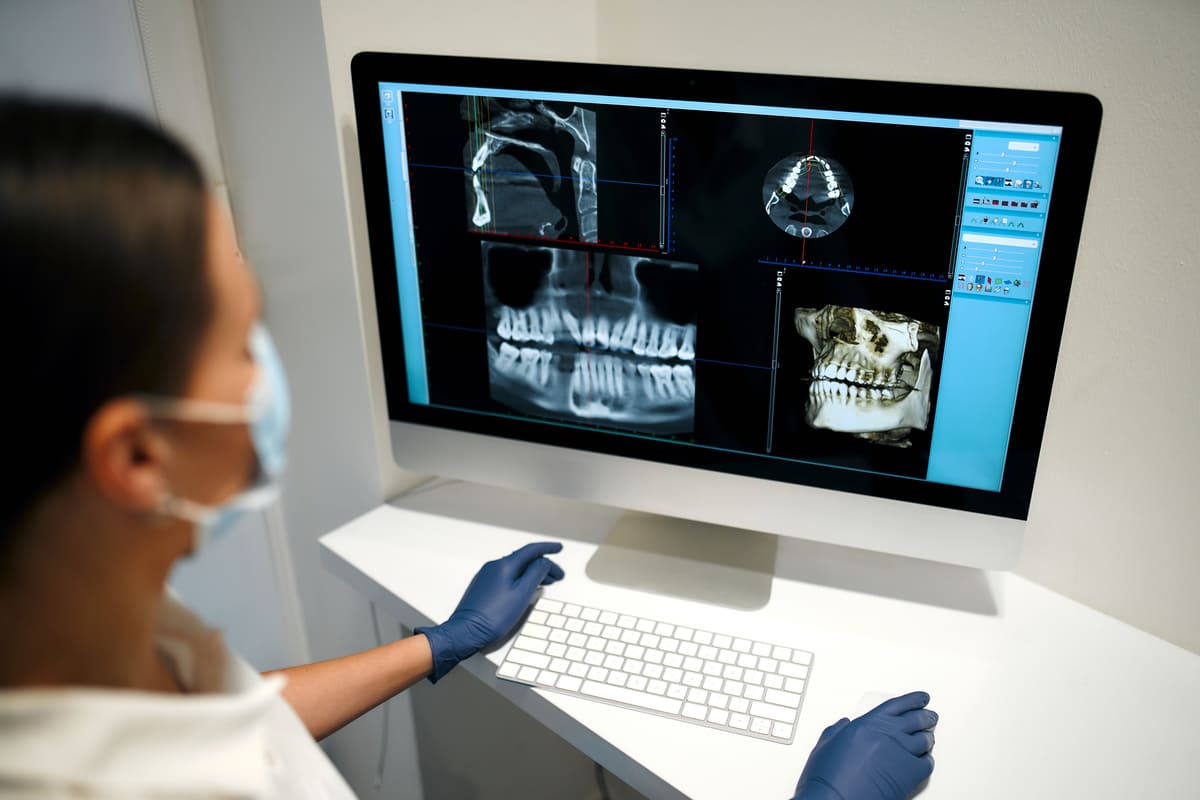 Imagen destacada de “Errores frecuentes en radiología dental y cómo evitarlos”