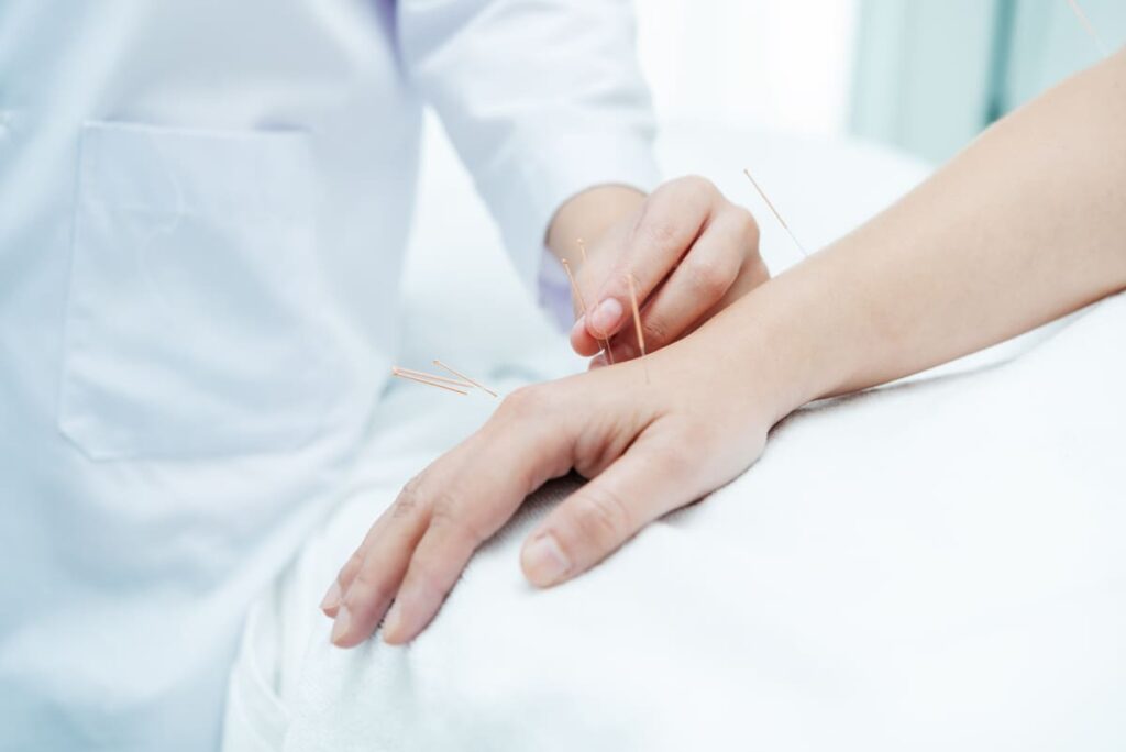 Procedimiento clínico cómo aplicar la acupuntura en el dolor neuropático